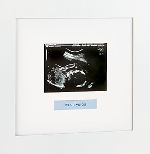 sonogram-frame